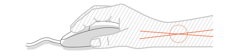 Mauvaise position de la souris